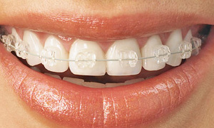 orthodoncy