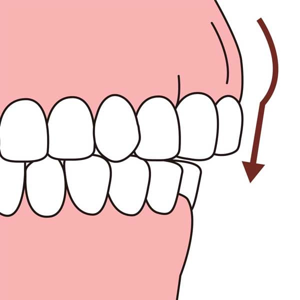 جراحی زیبایی لثه