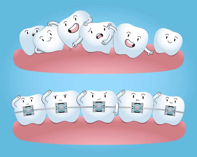 انواع ارتودنسی