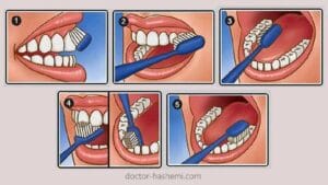 روش صحیح مسواک زدن
