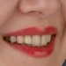 زرد شدن کامپوزیت